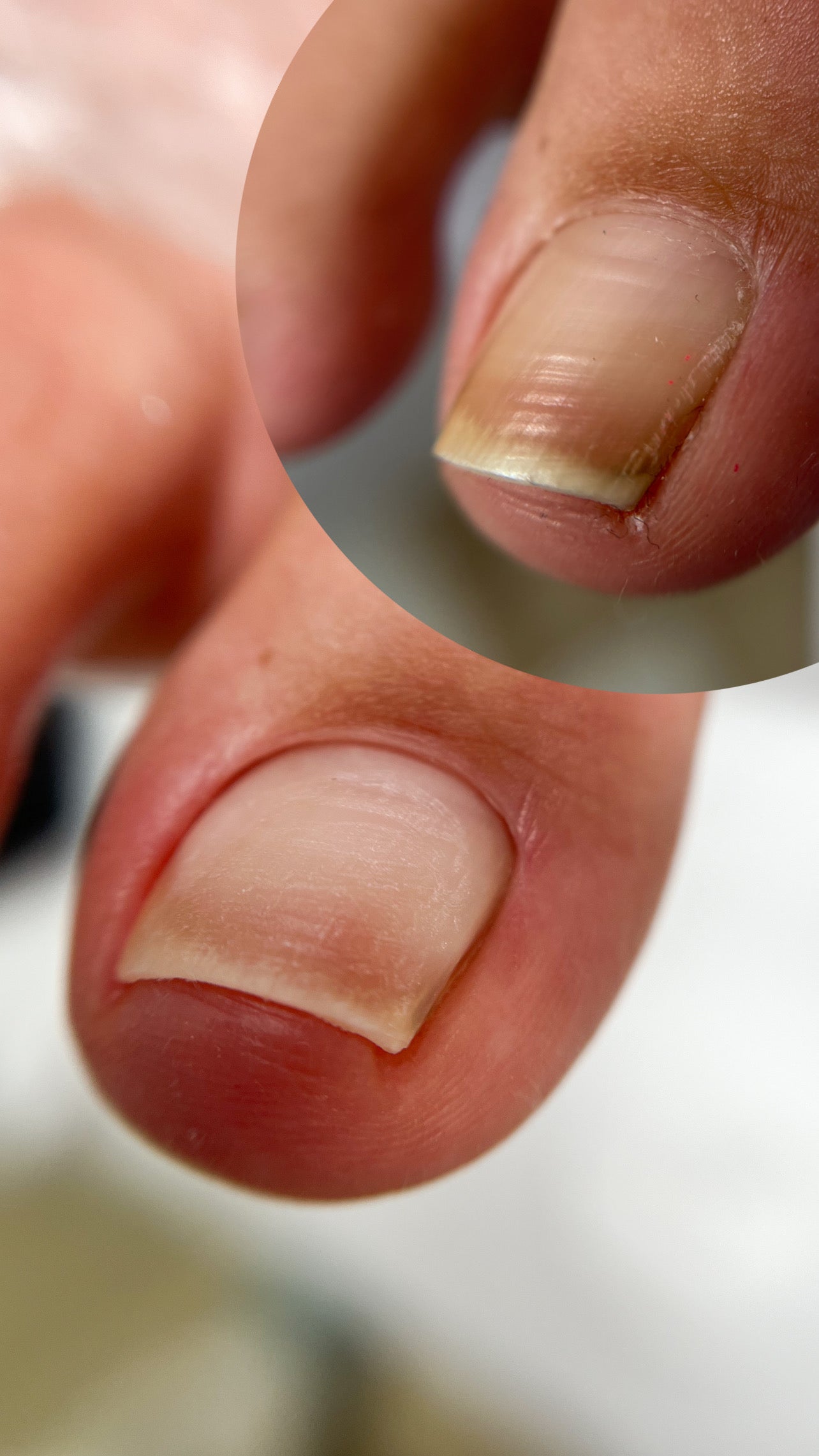 Esthetische Pedicure opleiding