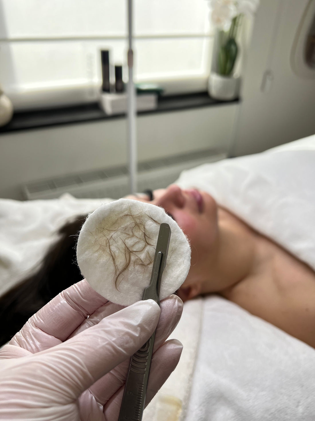 Waarom dermaplaning een must-have is in jouw gelaatsverzorging